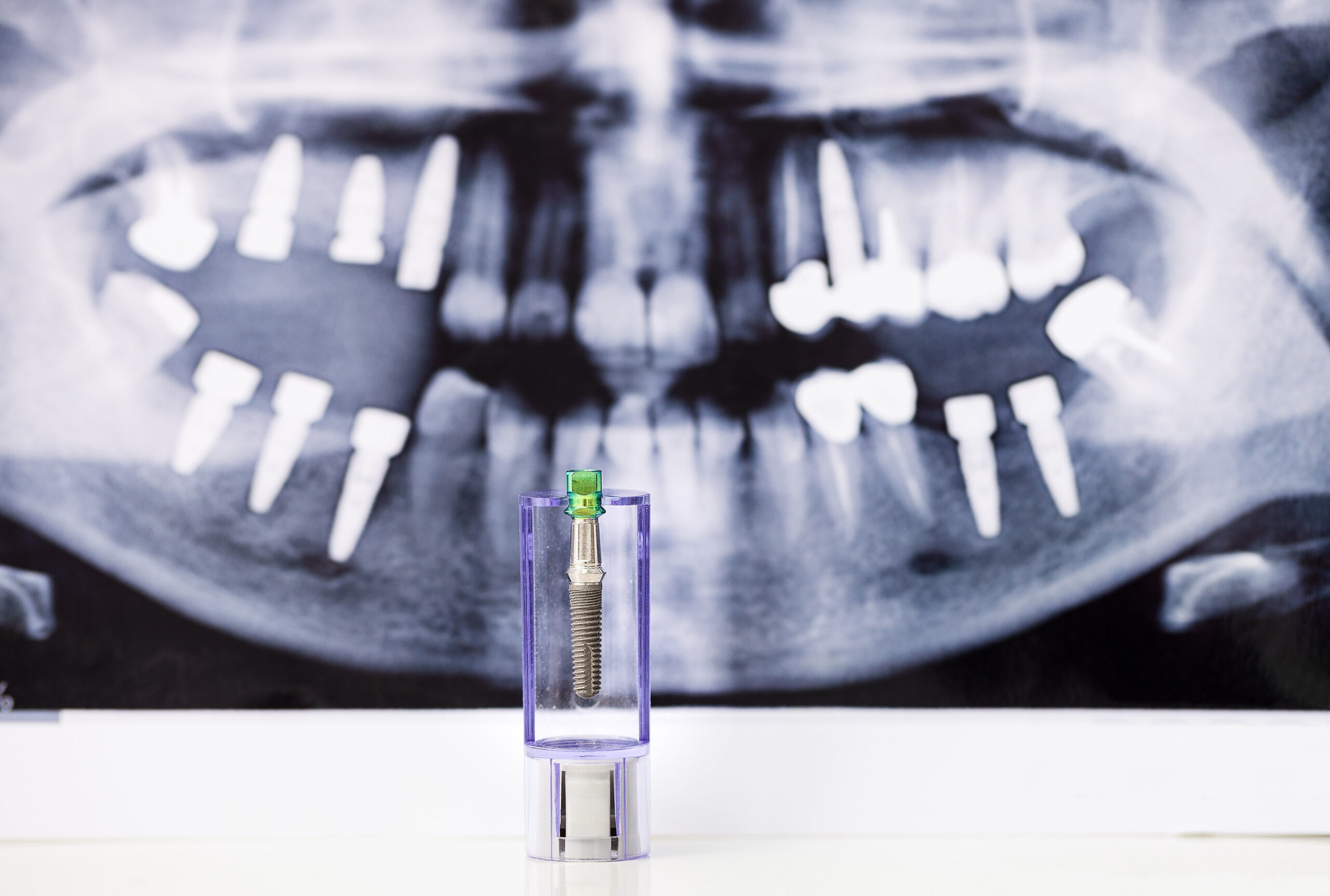 dental implant and x-ray
