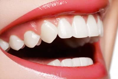 Las Vegas Cosmetic Dentistry Smile Makeovers