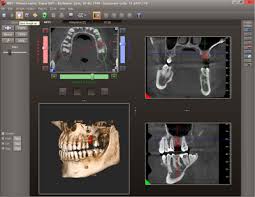 CBCT Cone Beam Computer Tomogrophy Image