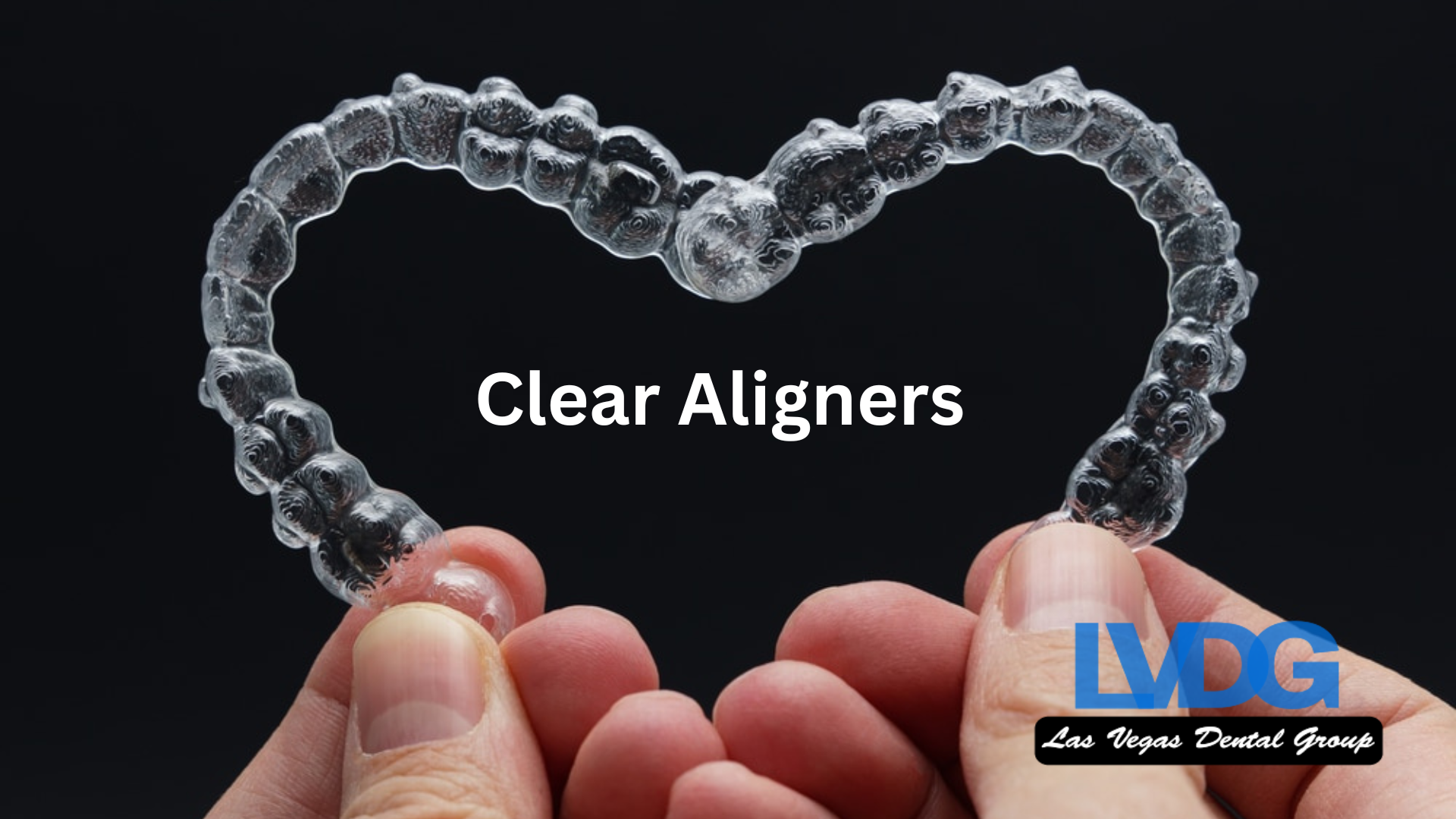 Aligners Las Vegas