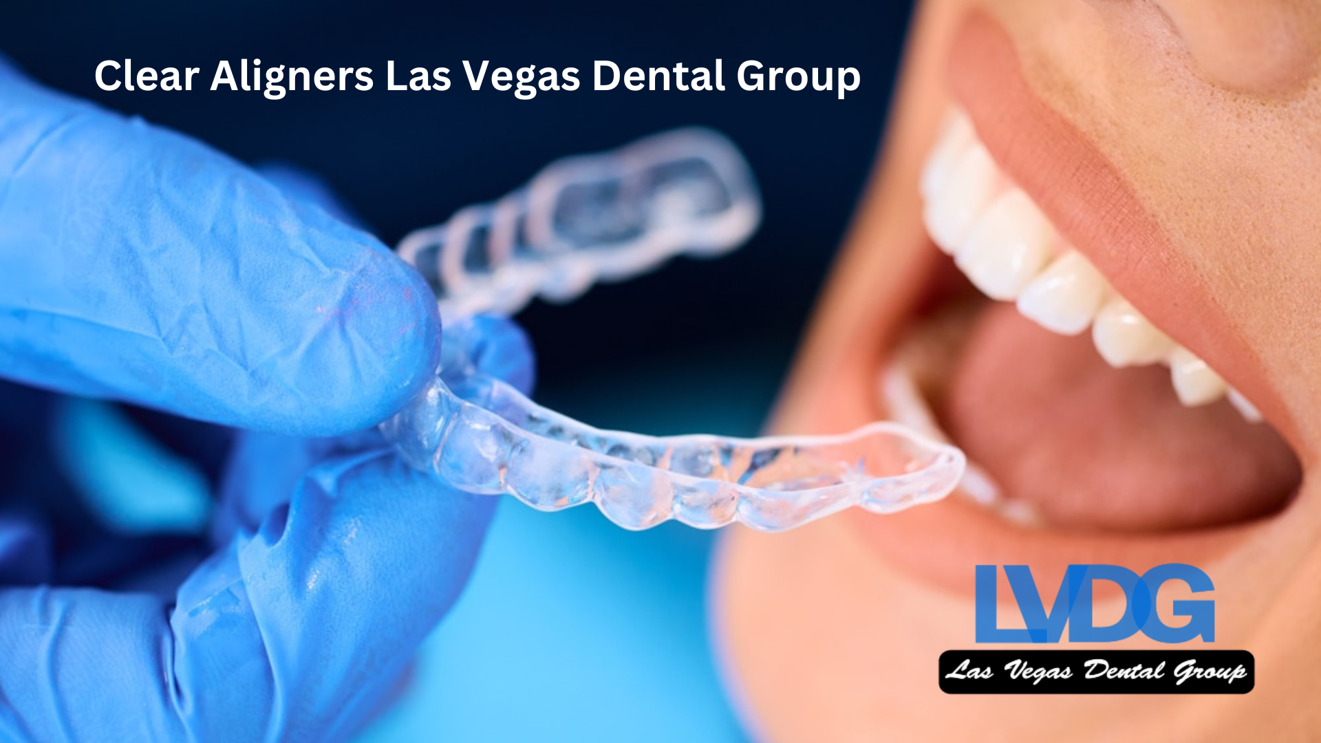 Clear Aligners Las Vegas Dental Group