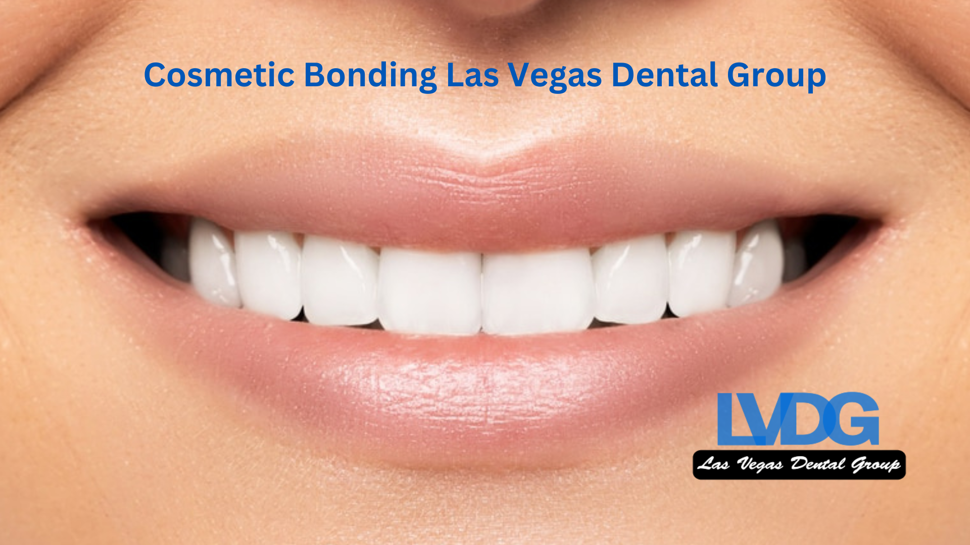 Cosmetic-Bonding-Las-Vegas-Dental-Group