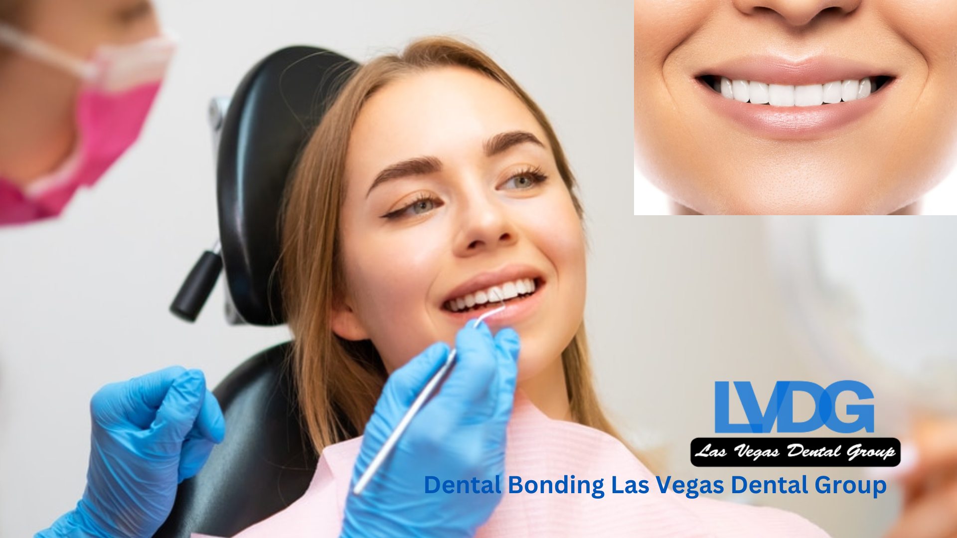 Dental Bonding Las Vegas Dental Group